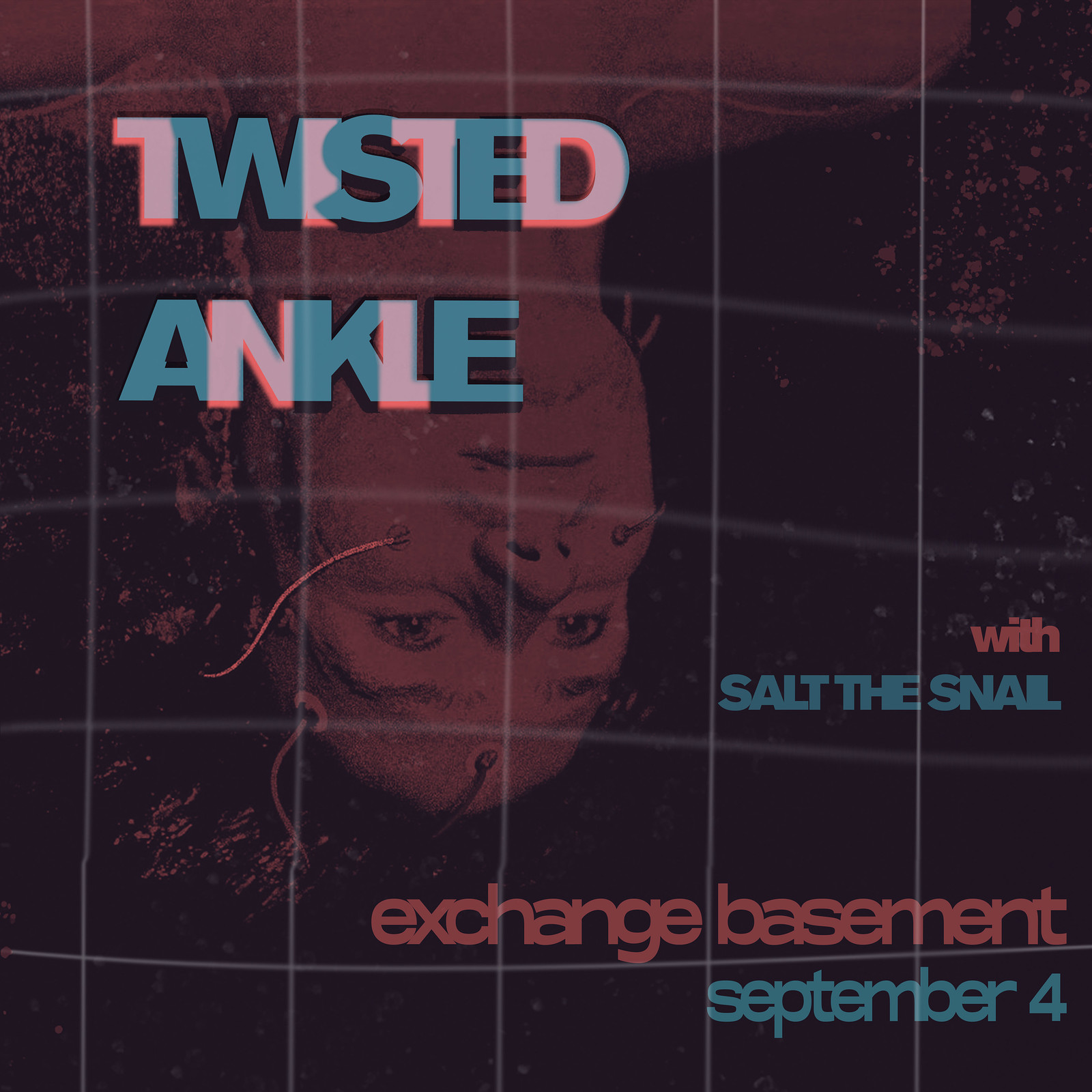 Twisted Ankle at Exchange