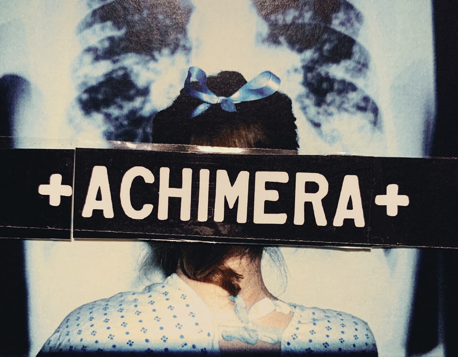 ACHIMERA: The Phenomenology of Illness Exhibition at Centrespace Gallery